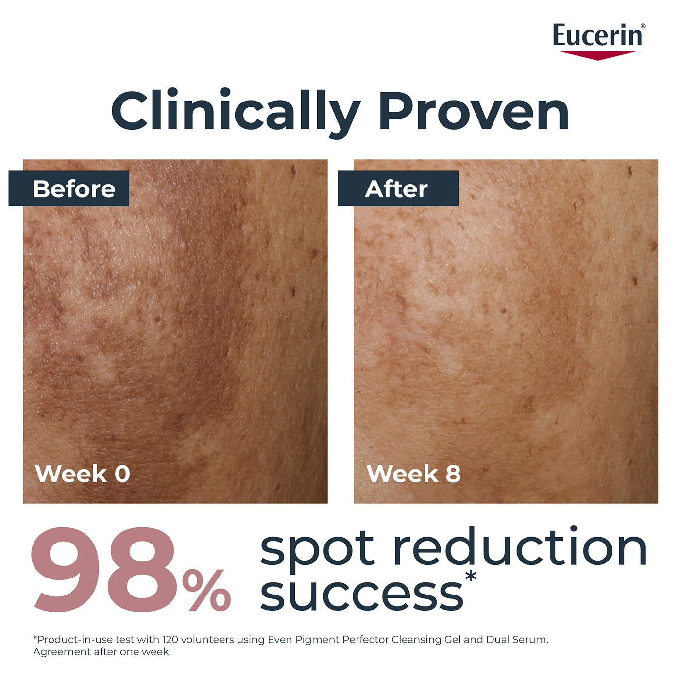 Eucerin Even Pigment Perfector Dual Face Serum Cream, 30ml