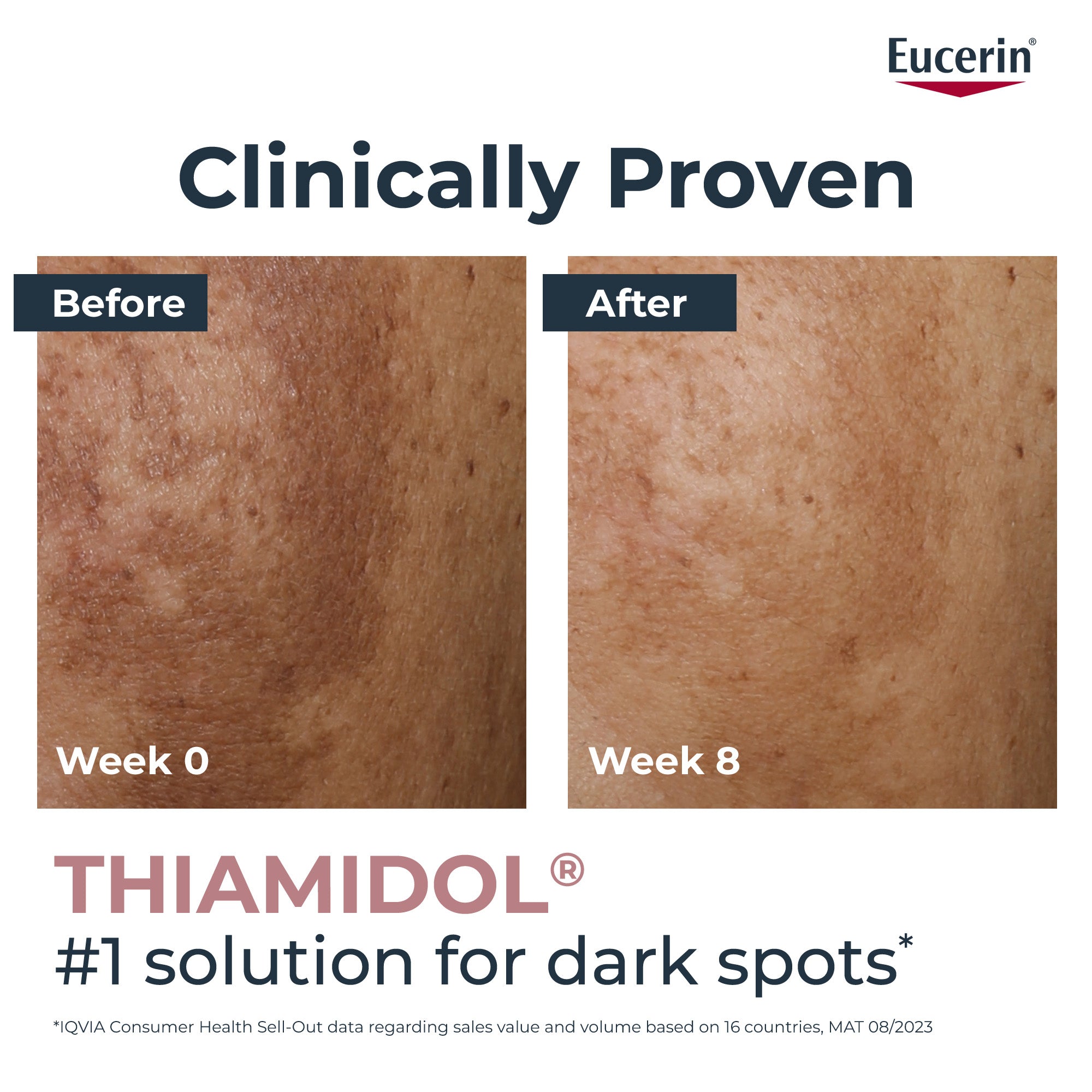 Eucerin Even Pigment Perfector Skin Perfecting Face Serum with Thiamidol and Hyaluronic Acid, 30ml