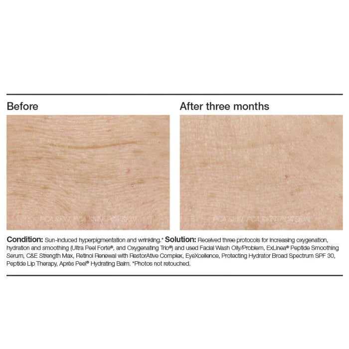 PCA Skin exlinea Peptide Smoothing Serum