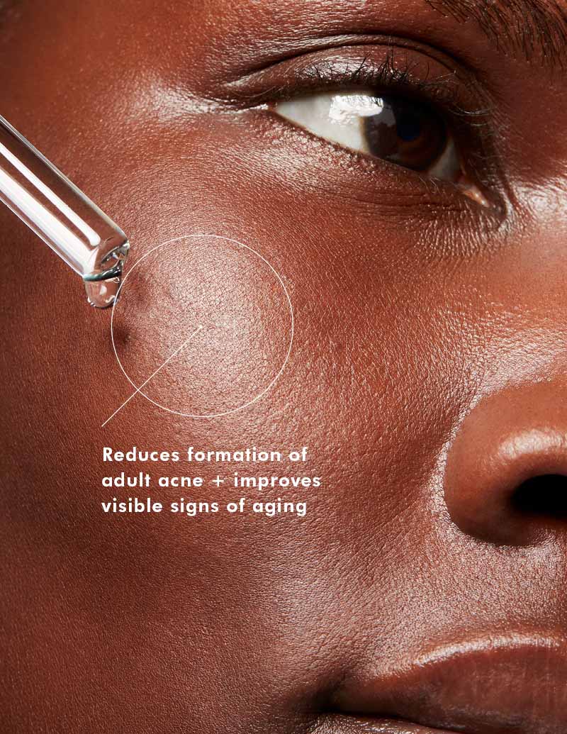 SkinCeutical Blemish & Age Defense Serum for Oily & Acne Skin 30ml